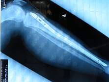 100-0018_IMG.JPG