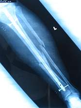 100-0019_IMG.JPG